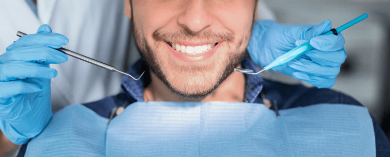 Teeth Whitening or Hollywood Smile