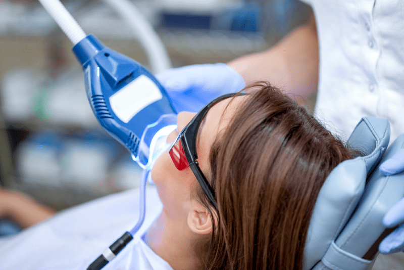 What Should I Do To Have Aesthetic and Beautiful Smile? Does Hollywood Smile Provide White Teeth? 4 Hollywood Smile