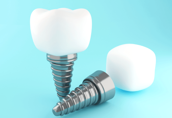 Markoj de Dental Implant - Kiun Markon de Dental Implant Mi Devus Elekti