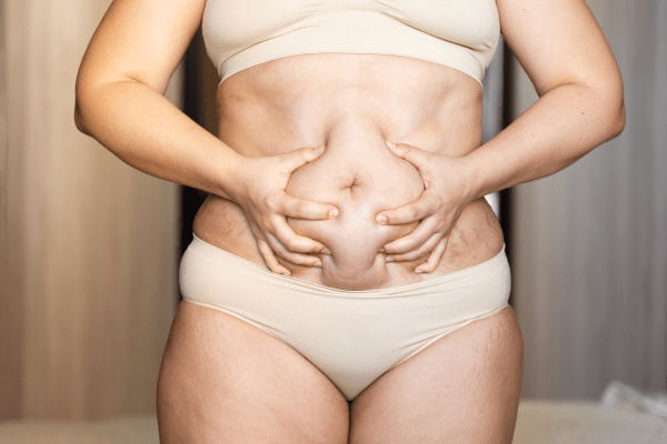 Gastric Sleeve Turkey එදිරිව Malta A සංසන්දනය