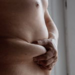 Gastric Sleeve UK vs Turkey Cons Pros and Prices