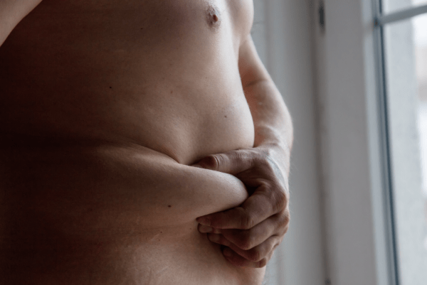 Gastric Sleeve UK vs Turkey Cons Pros and Prices