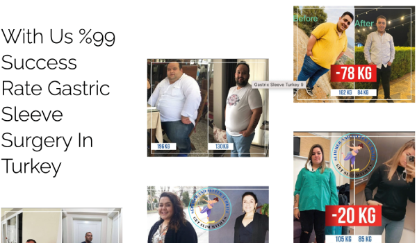 Gastric sleeve packages turkey 1