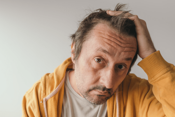 Hair Transplant India vs Turkey Cons Pros and Prices