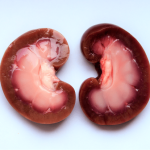 Which Countries Can I Queue For An Organ Transplant