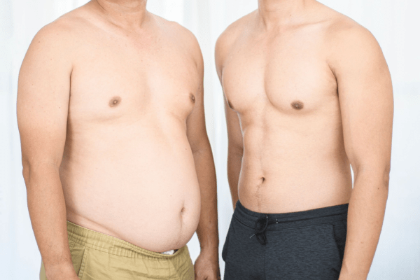 Gastric Bypass နှင့် Gastric Sleeve