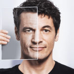 Facelift Aesthetics in Greece