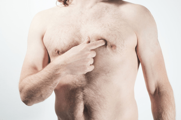 Gynaecomastia Surgery