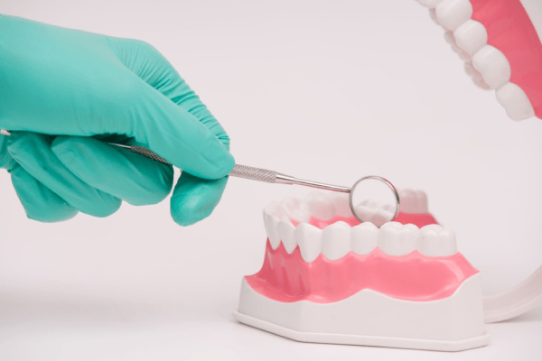 Dental Treatment in UK