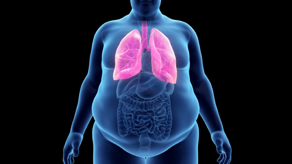 Safe and Affordable Bariatric Surgery in Turkey 2 Bariatric Surgery in Turkey