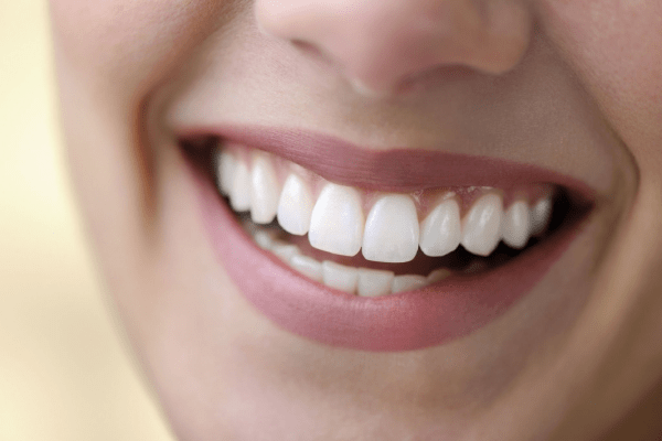 Teeth Whitening in Istanbul