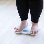 Gastric Sleeve