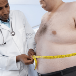 Bariatric Surgery in Turkey