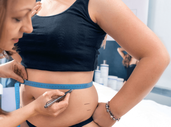 Mommy Makeover in Turkey