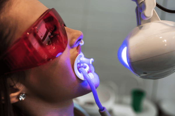 Teeth Whitening in Turkey: Pros and Cons, Before and After 2 Teeth Whitening in Turkey