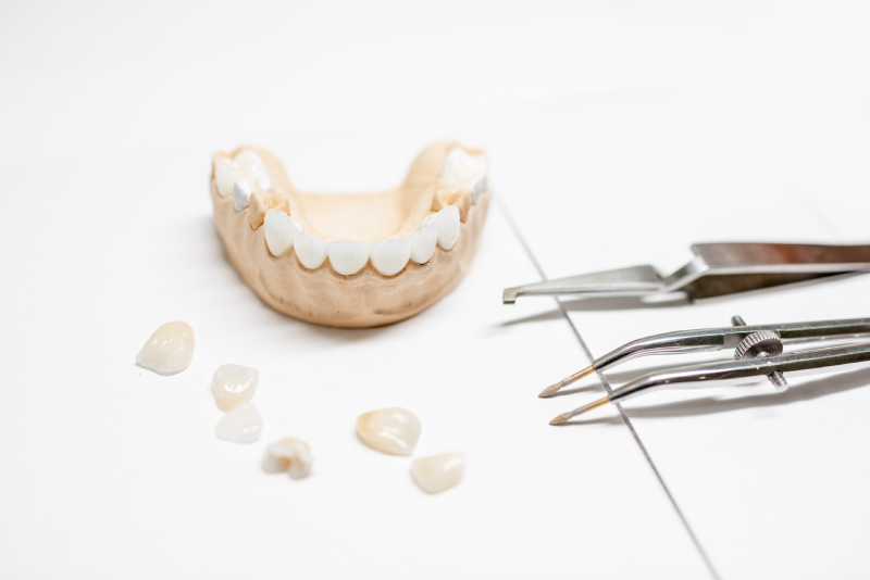 Implants dentals a Geòrgia