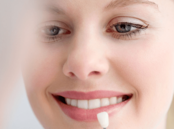 Veneers dental mirah di Turki