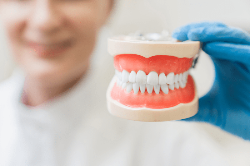 Implantanti dentali