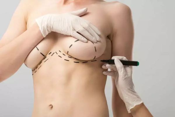 Breast Lift after Delivery How Long Should You Wait