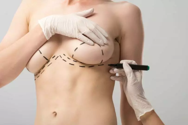 Breast Lift after Delivery- How Long Should You Wait?