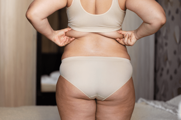 Gastric Balloon Turkey: A Journey to Weight Loss Bliss 1 Gastric Balloon Turkey A Journey to Weight Loss Bliss