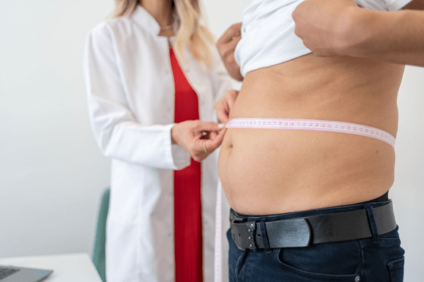 Chirurgie bypass gastrică