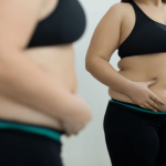 Kusadasi Gastric Balloon