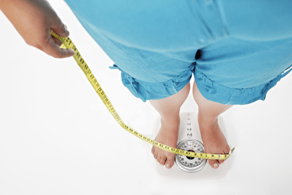 Gastric Sleeve