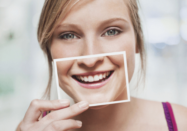 I-Zirconium Dental Veneers noma i-Porcelain e-Kusadasi