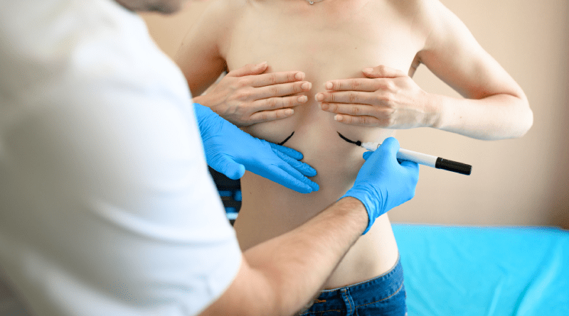 Cirurxía de aumento de mama en Turquía