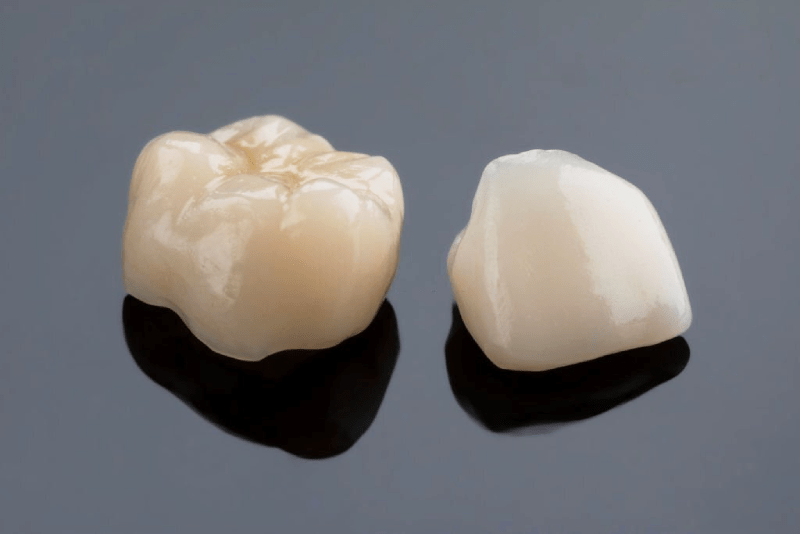 Exploring Ceramic Crowns in Kusadasi: A Comprehensive Guide 2 Ceramic Crowns in Kusadasi