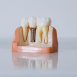 Dental